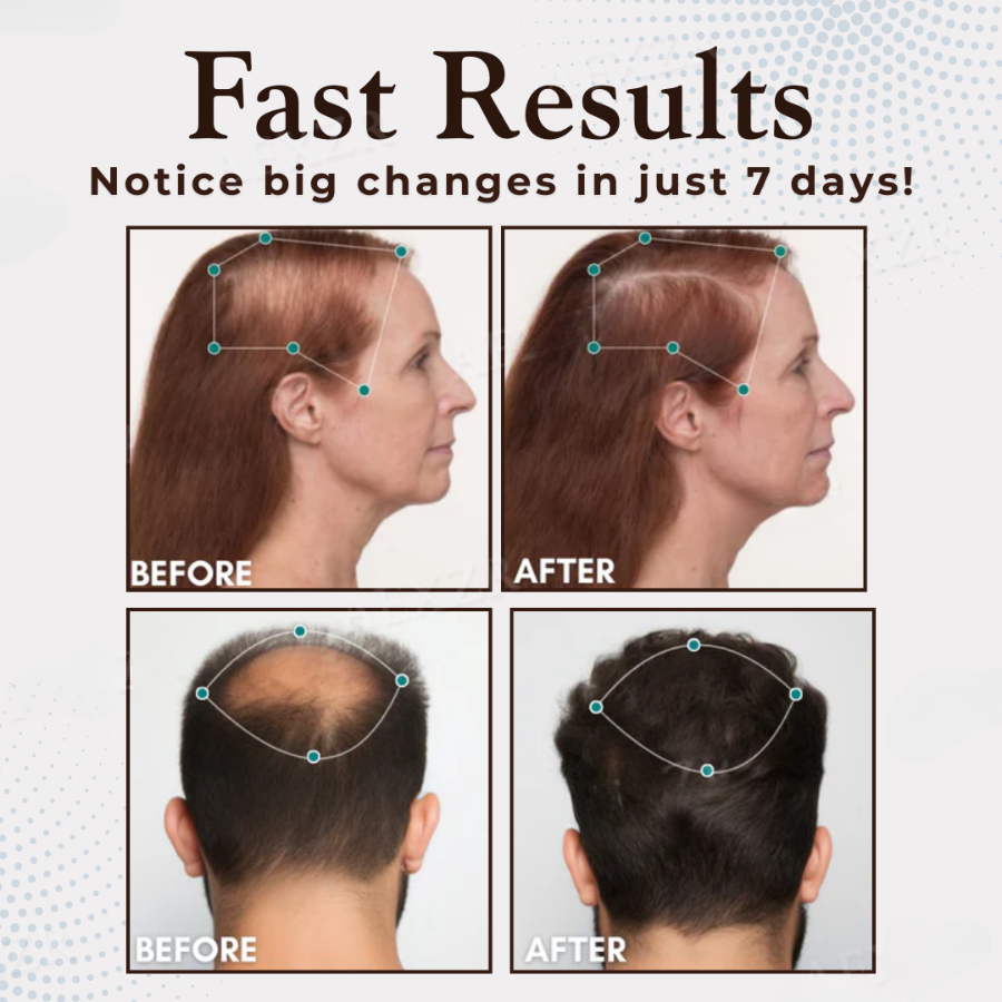 Fivfivgo™ Haarwuchs Boost-Kapseln