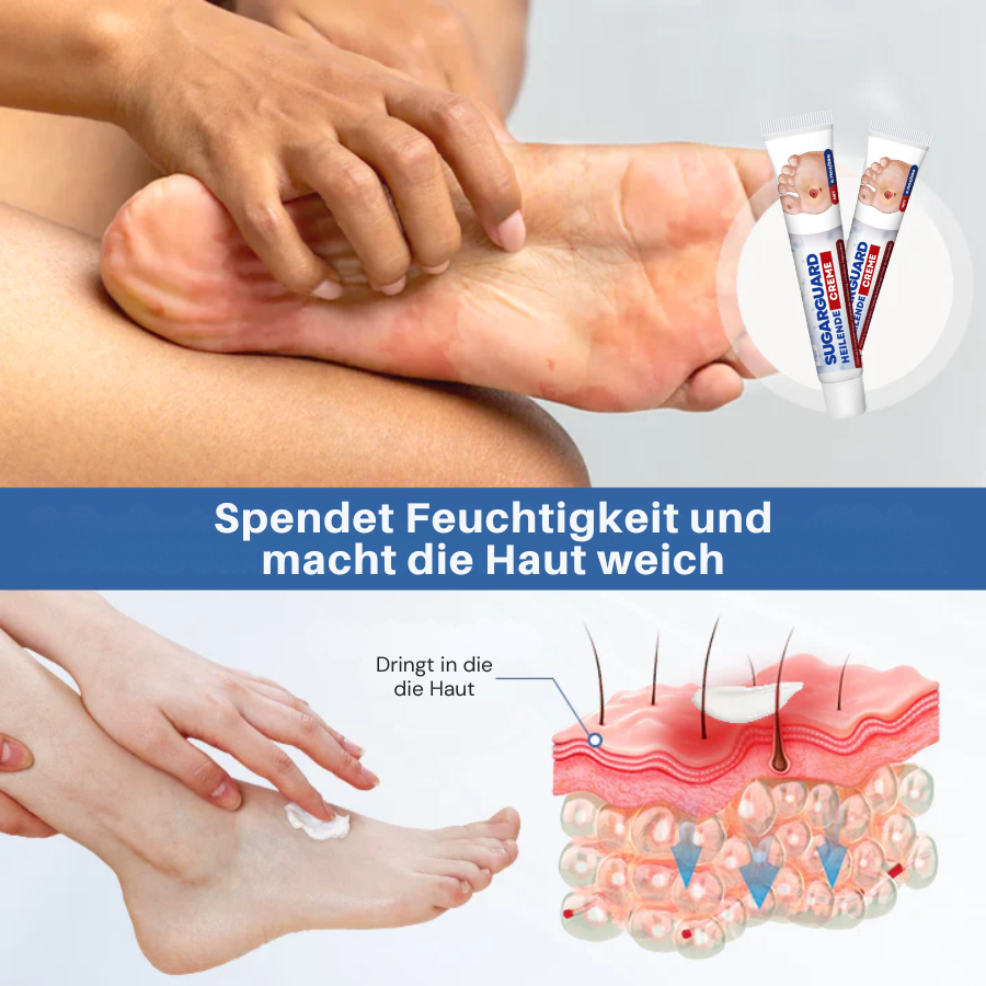 Cvreoz® SugarGuard Heilende Creme