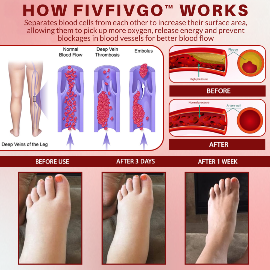 Fivfivgo™ Rosskastanie SwellAway Massage-Gel