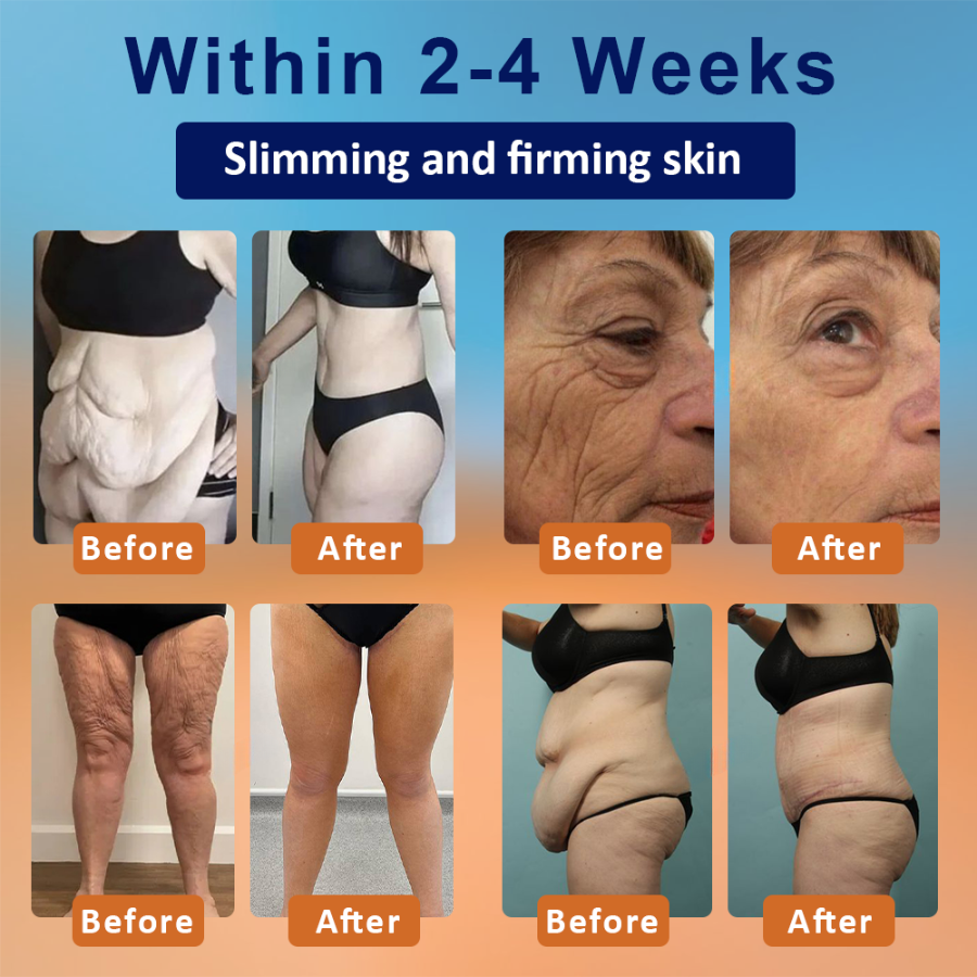 Fivfivgo™ Fat Regulator Body Cream