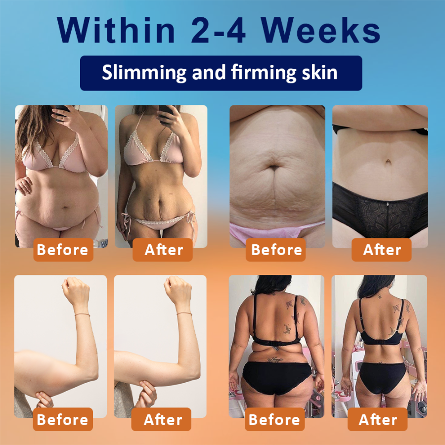 Fivfivgo™ Fat Regulator Body Cream