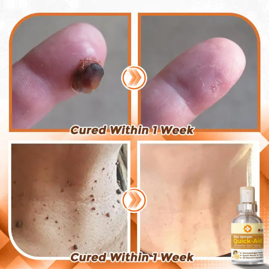Fivfivgo™ Bee Venom Quick Relief Versatile Skin Spray 🇩🇪 Dermatologist Approved