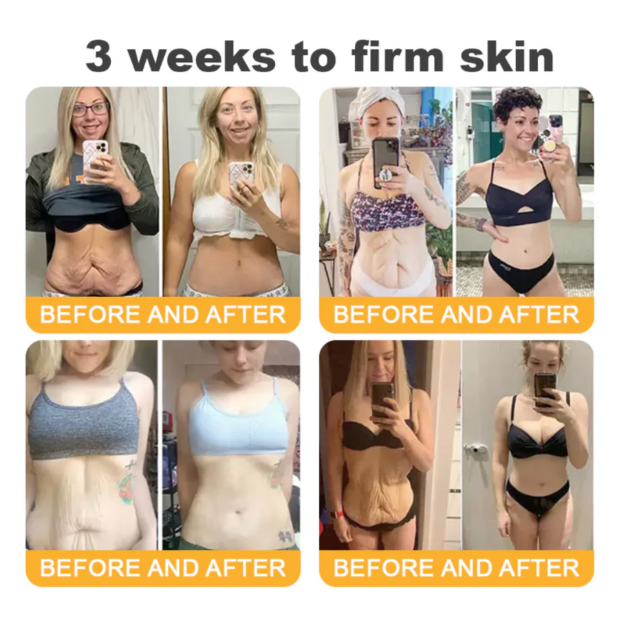 Fivfivgo™ Advanced Collagen Peptide Firming Cream (Address Crepe & Sagging) 🔥 LAST DAY SALE 70% OFF
