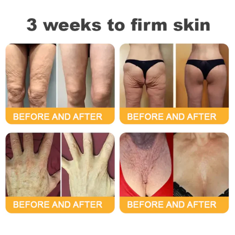 Fivfivgo™ Advanced Collagen Peptide Firming Cream (Address Crepe & Sagging) 🔥 LAST DAY SALE 70% OFF