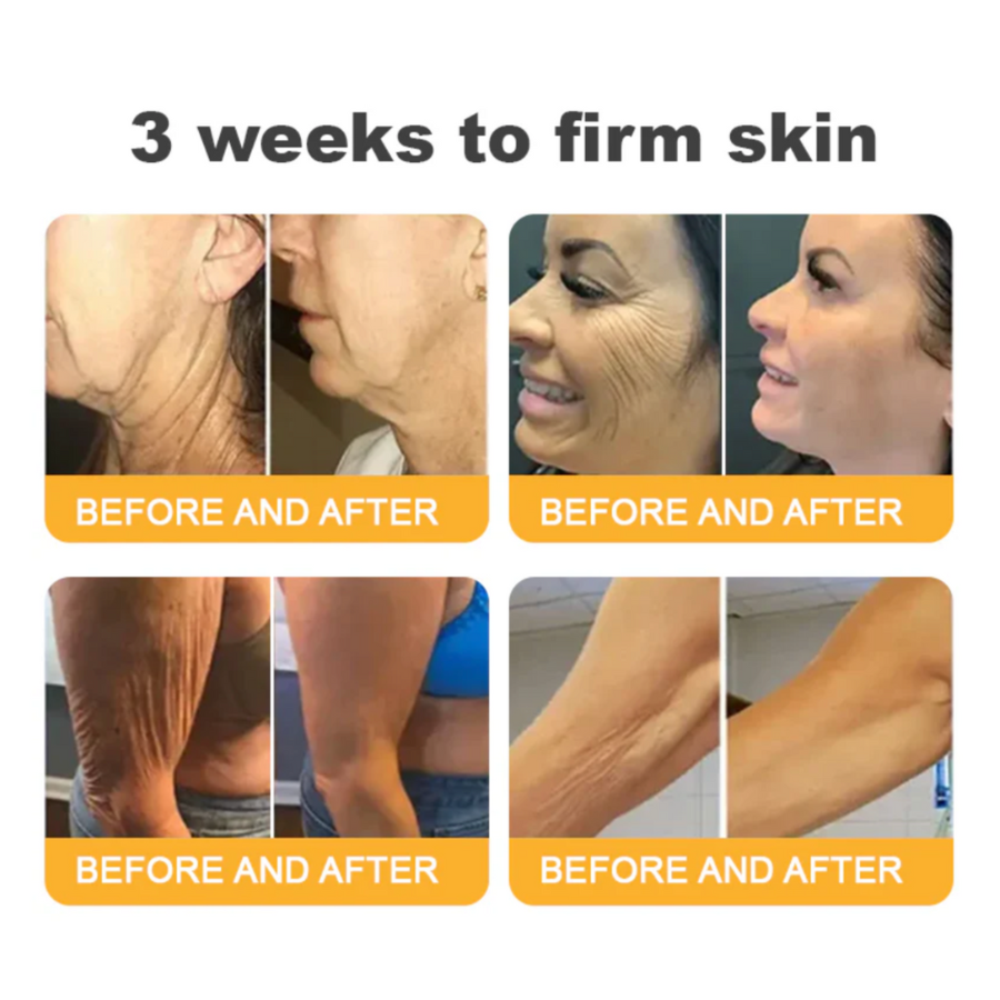 Fivfivgo™ Advanced Collagen Peptide Firming Cream (Address Crepe & Sagging) 🔥 LAST DAY SALE 70% OFF