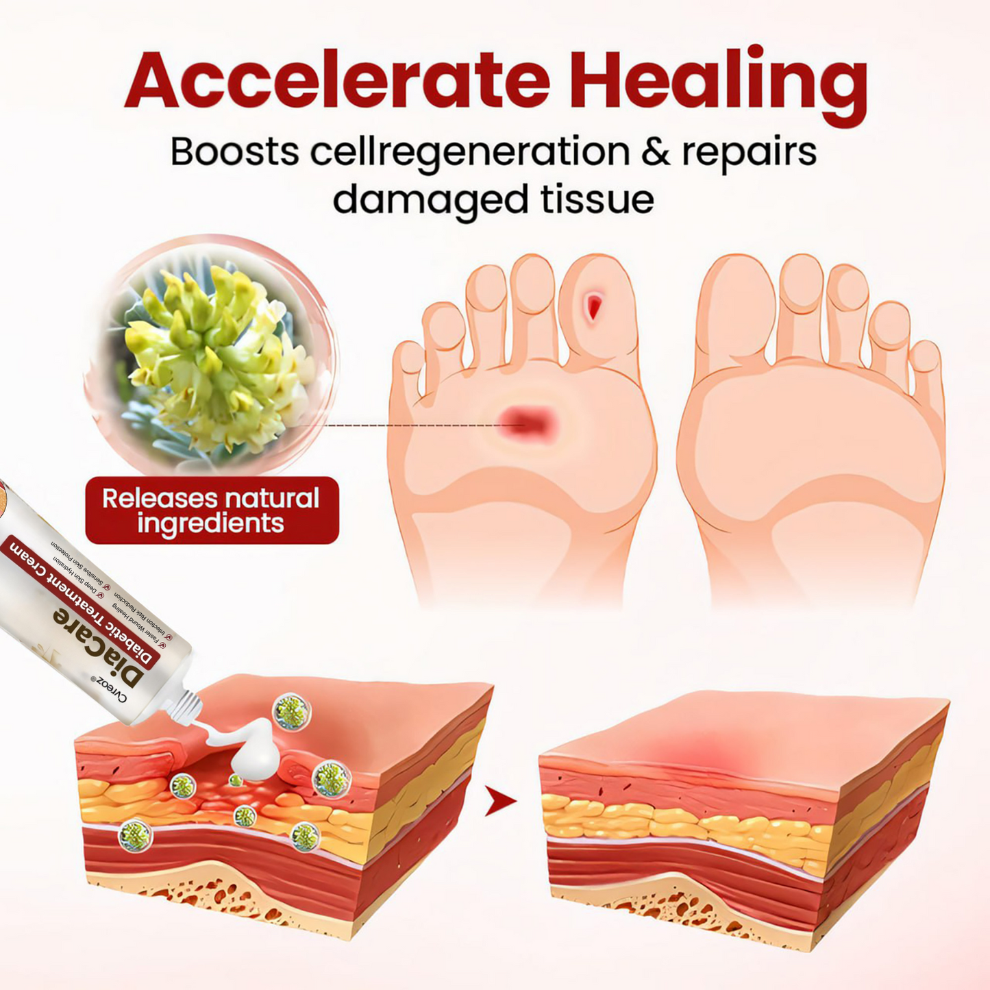 Cvreoz® DiaCare Diabetic Treatment Cream