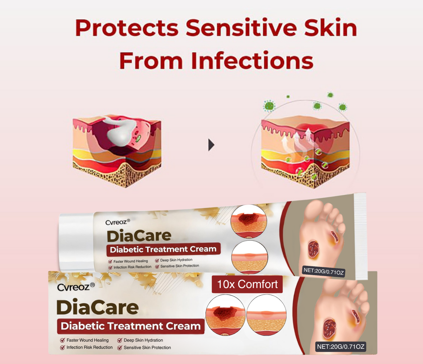 Cvreoz® DiaCare Diabetic Treatment Cream