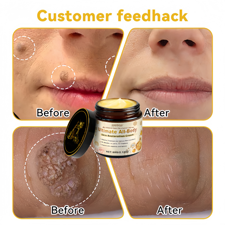 Fivfivgo™ Bee Poison Skin Treatment Cream