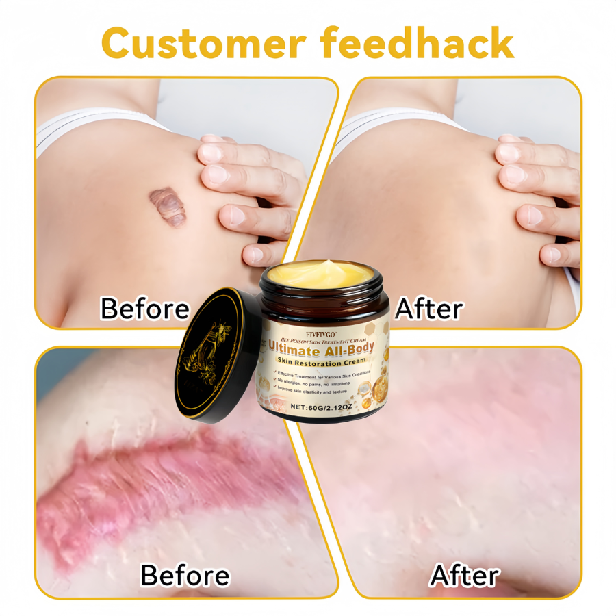 Fivfivgo™ Bee Poison Skin Treatment Cream