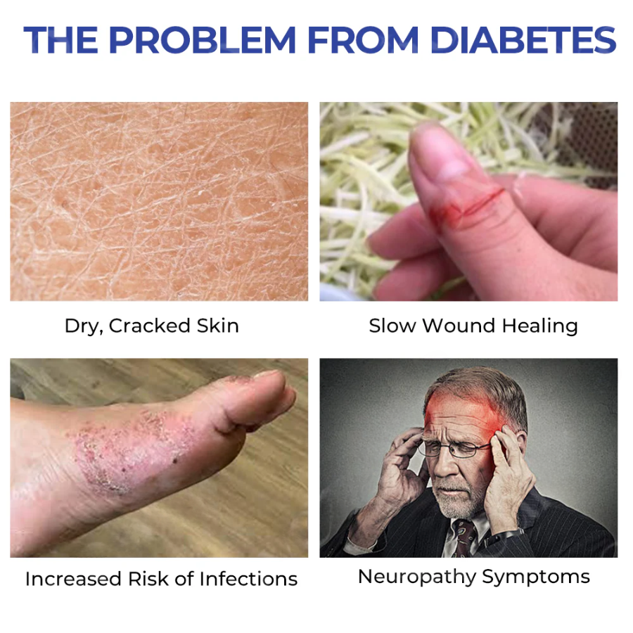 Fivfivgo™ DiaRelief Moisture Cream (Specialized for Diabetics)