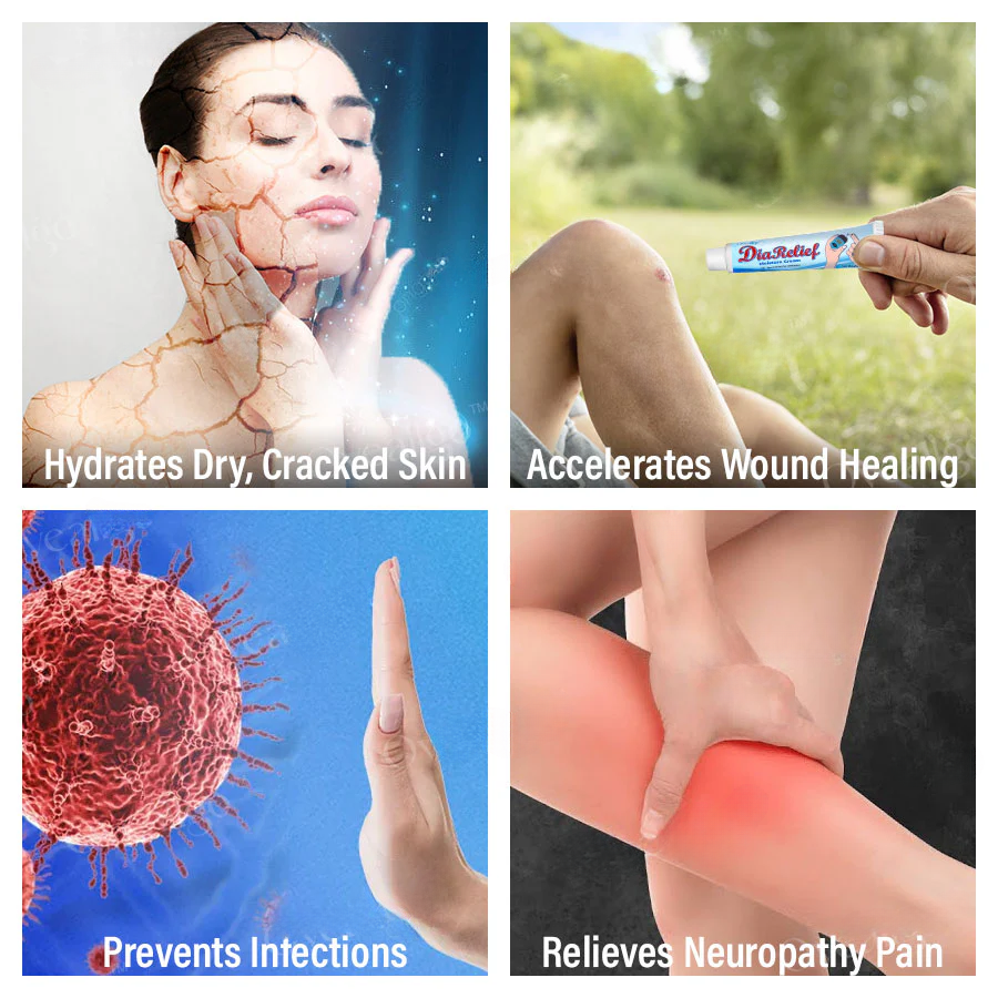 Fivfivgo™ DiaRelief Moisture Cream (Specialized for Diabetics)