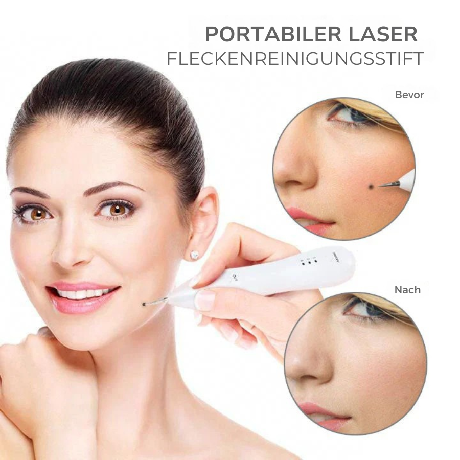 Fivfivgo™ Tragbarer Laser-Spot-Reinigungsstift