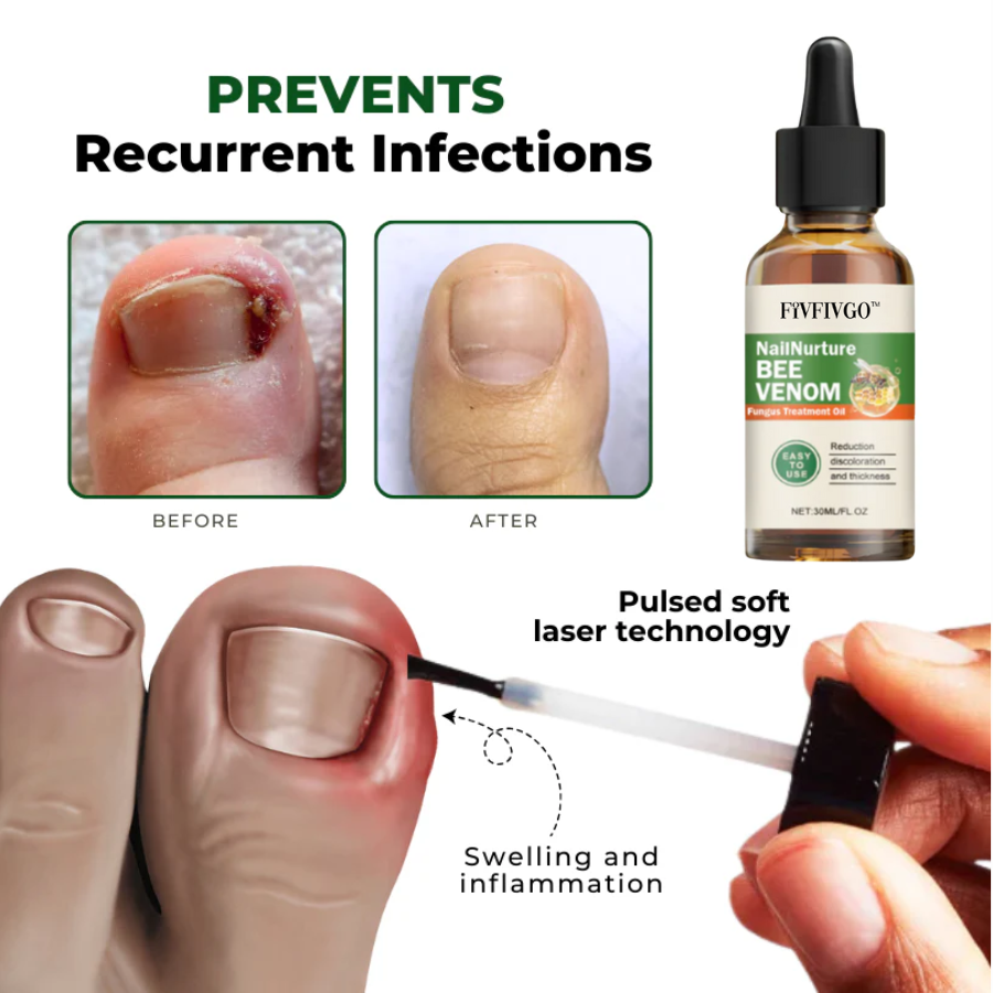 Fivfivgo™ NailNurture Bienengift Fungus Behandlungsöl