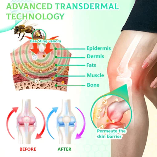Fivfivgo™ Crème ACTIVE de Thérapie Articulaire et Osseuse au Venin d'Abeille (Récupération Complète du Corps, Formule Naturelle Pure)