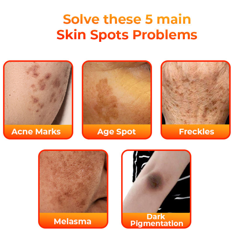 Fivfivgo™ Kojic Acid Dark Spot Corrector Soap