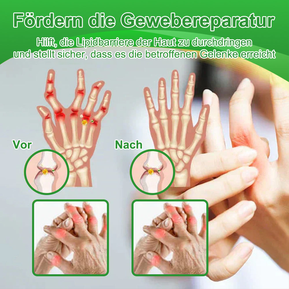Fivfivgo™ Lidocain 5-Minuten-Schmerzlinderungs-Heilspray