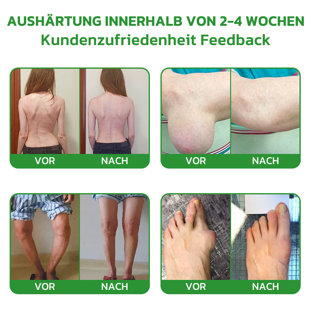 Fivfivgo™ Lidocain 5-Minuten-Schmerzlinderungs-Heilspray