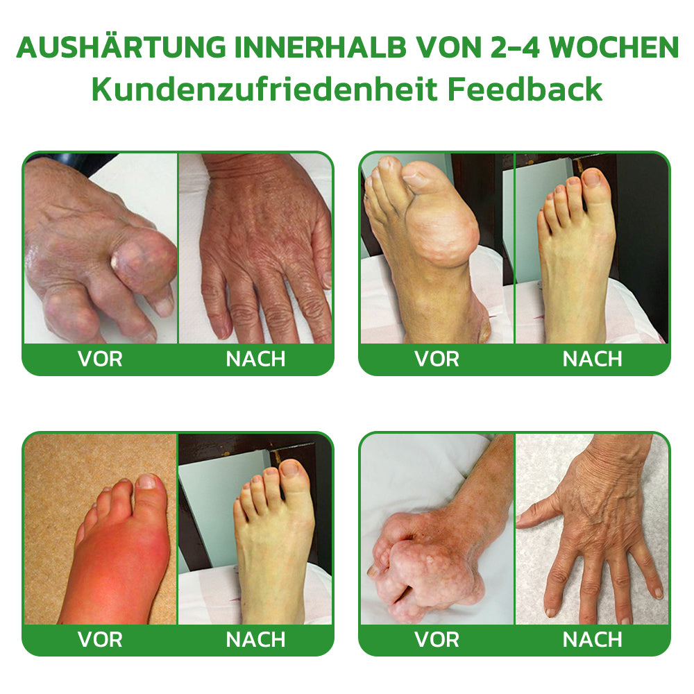 Fivfivgo™ Lidocain 5-Minuten-Schmerzlinderungs-Heilspray