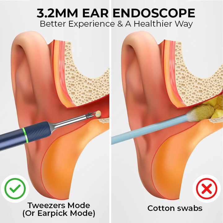 Fivfivgo™ EarWax Clean Pro Otoskop mit Wi-Fi sichtbarem Löffel zur Wachsentfernung