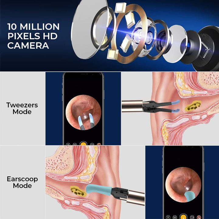 Fivfivgo™ Otoscope EarWax Clean Pro avec cuillère d'élimination du cérumen visible en Wi-Fi