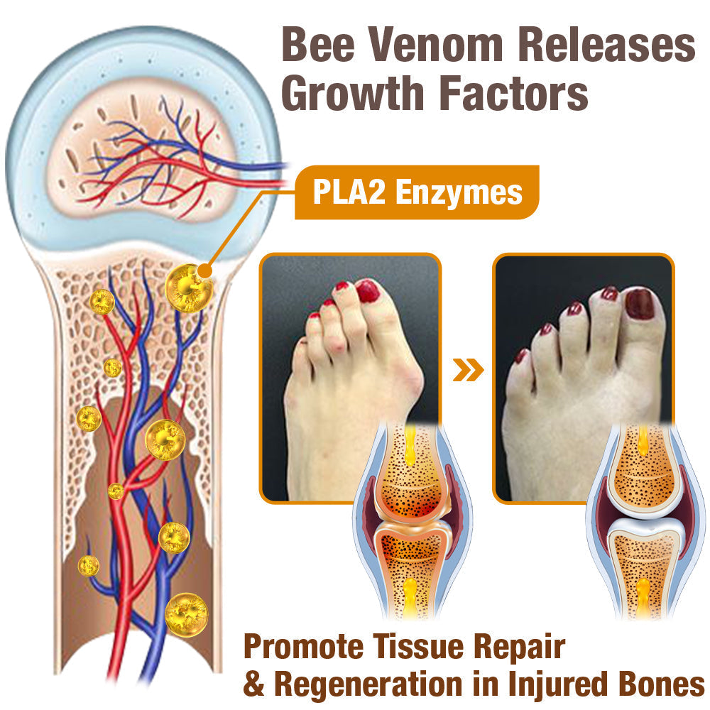 Fivfivgo™ HalluxCare Bee Venom Treatment Cream