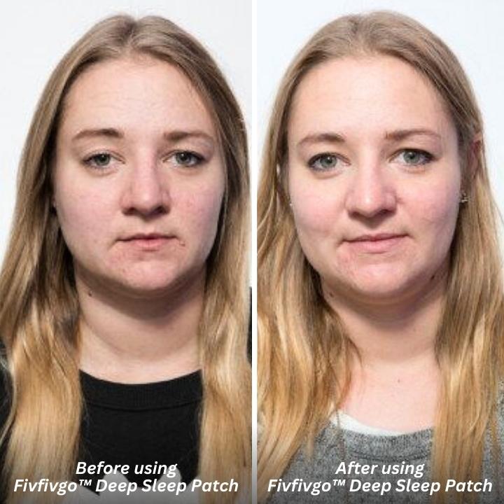 Fivfivgo™ Tiefschlaf-Patch