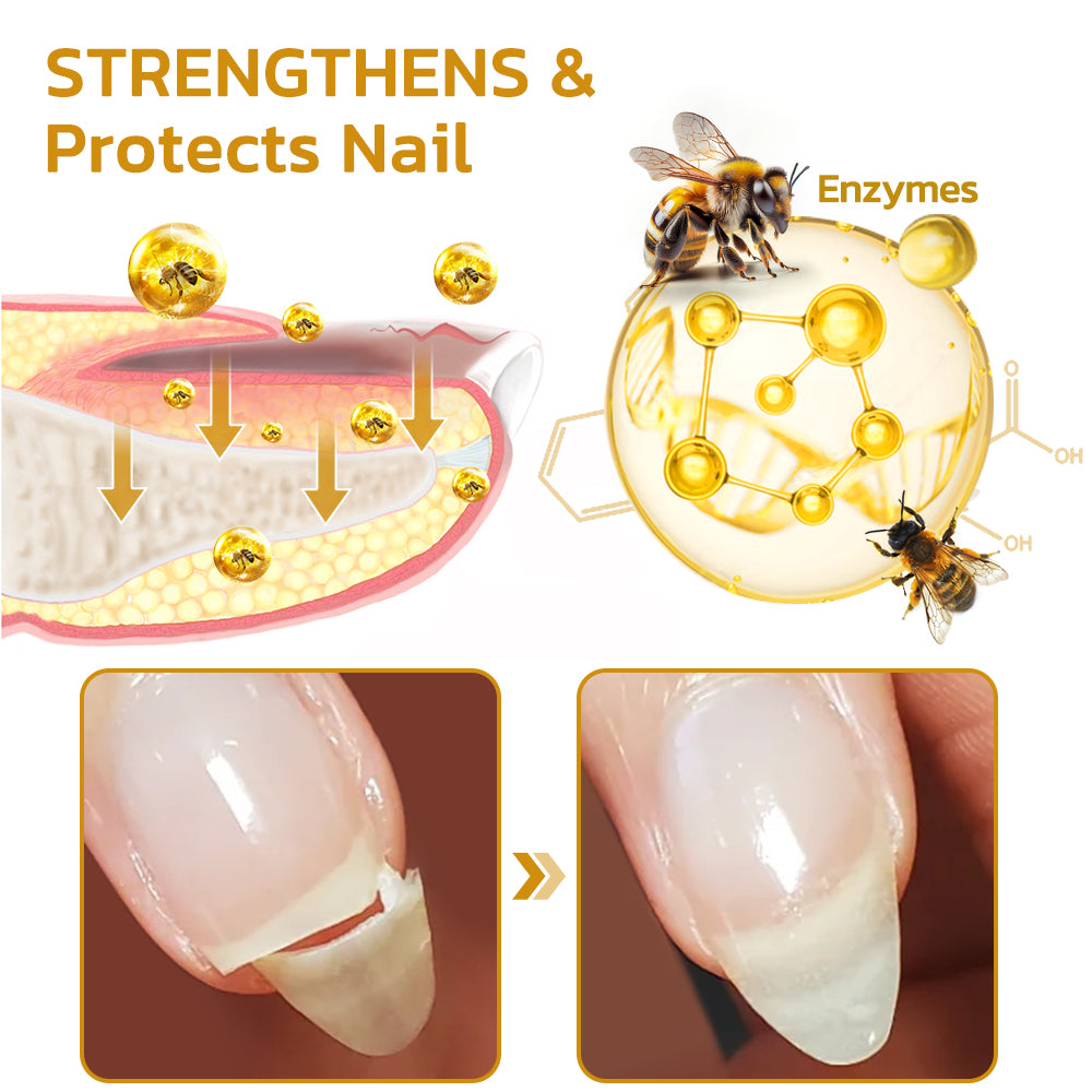 Fivfivgo™ NailPlus Starkes Bienengift 7 Tage Wachstum Nagelgel