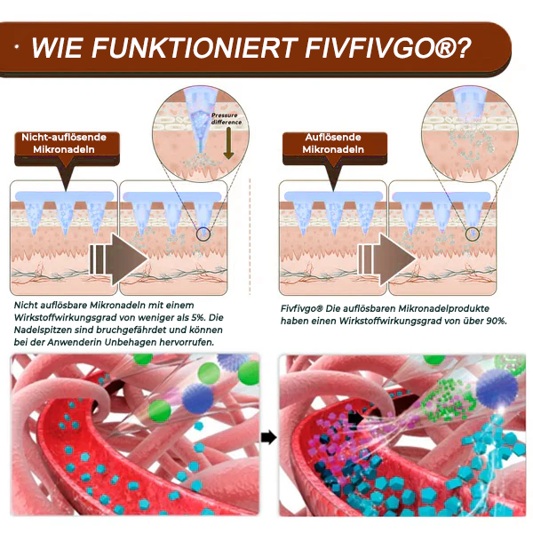 Fivfivgo® Botox-Bienengift-Mikronadelpflaster (schmerzfreie, lang anhaltende Behandlung von hartnäckigen Falten und Hautproblemen)