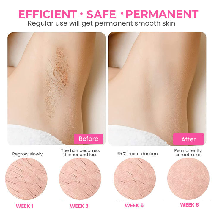 Mousse depilatoria alla cera d'api Fivfivgo™ SmoothSweep