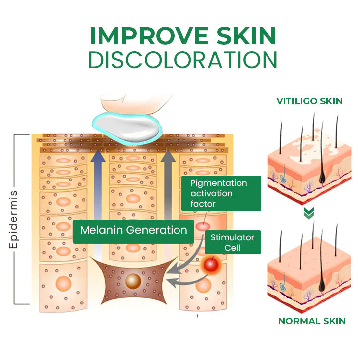 Fivfivgo™ VitiligoFix Revitalize eliksiiri