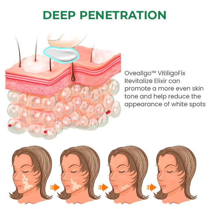 Fivfivgo™ VitiligoFix Élixir de revitalisation