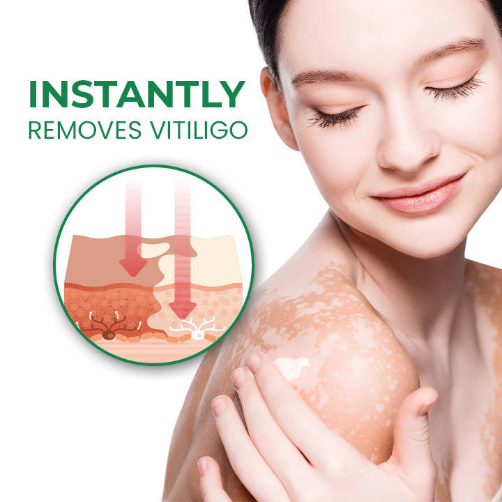 Fivfivgo™ VitiligoFix Élixir de revitalisation