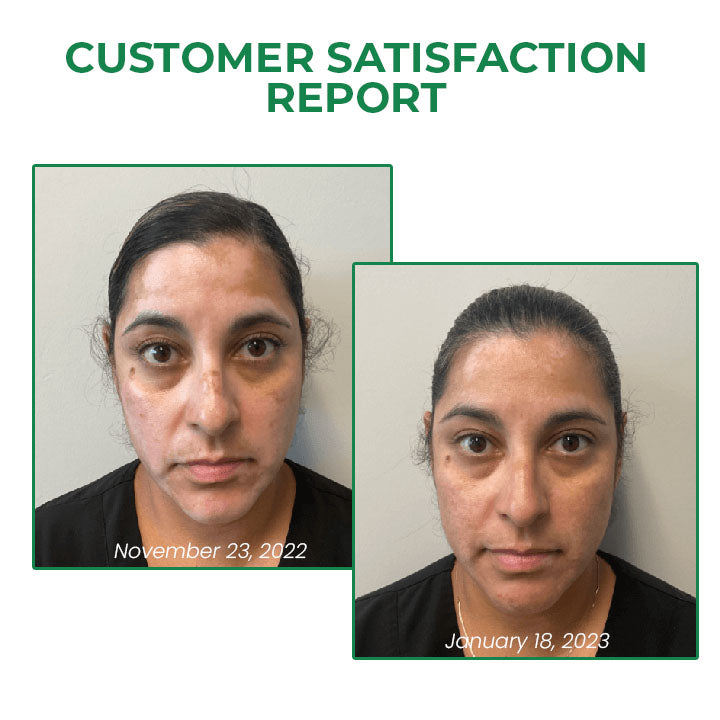 Fivfivgo™ VitiligineFix Elisir rivitalizzante