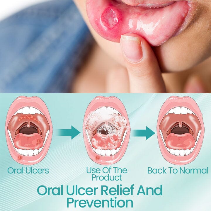 Fivfivgo™ RadiantSmile Oral Rinse