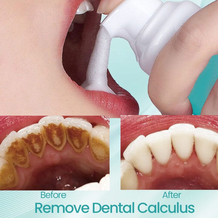 Fivfivgo™ RadiantSmile Oral Rinse