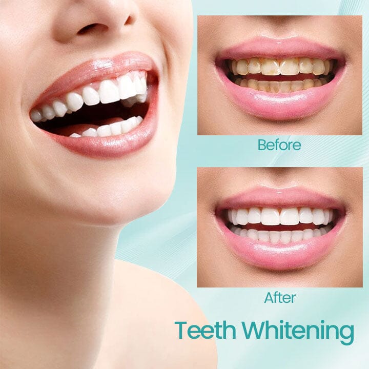 Fivfivgo™ RadiantSmile Oral Rinse