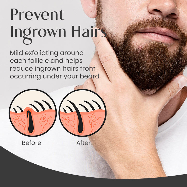 Fivfivgo™ BeardGRO Bio-Pflegeöl