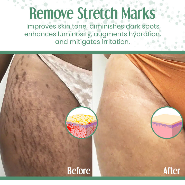 Fivfivgo™ Fortschrittliche hautstraffende Creme (Anti-Falten, fortschrittliche Hautstraffung, Wiederherstellung der Hautelastizität)