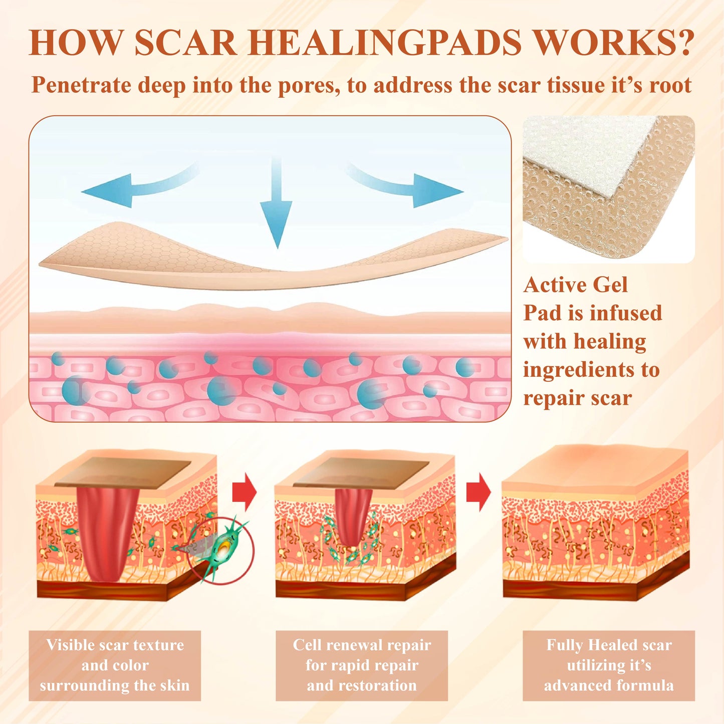 Fivfivgo™ ScarEase Silicone Foam Healing Pads