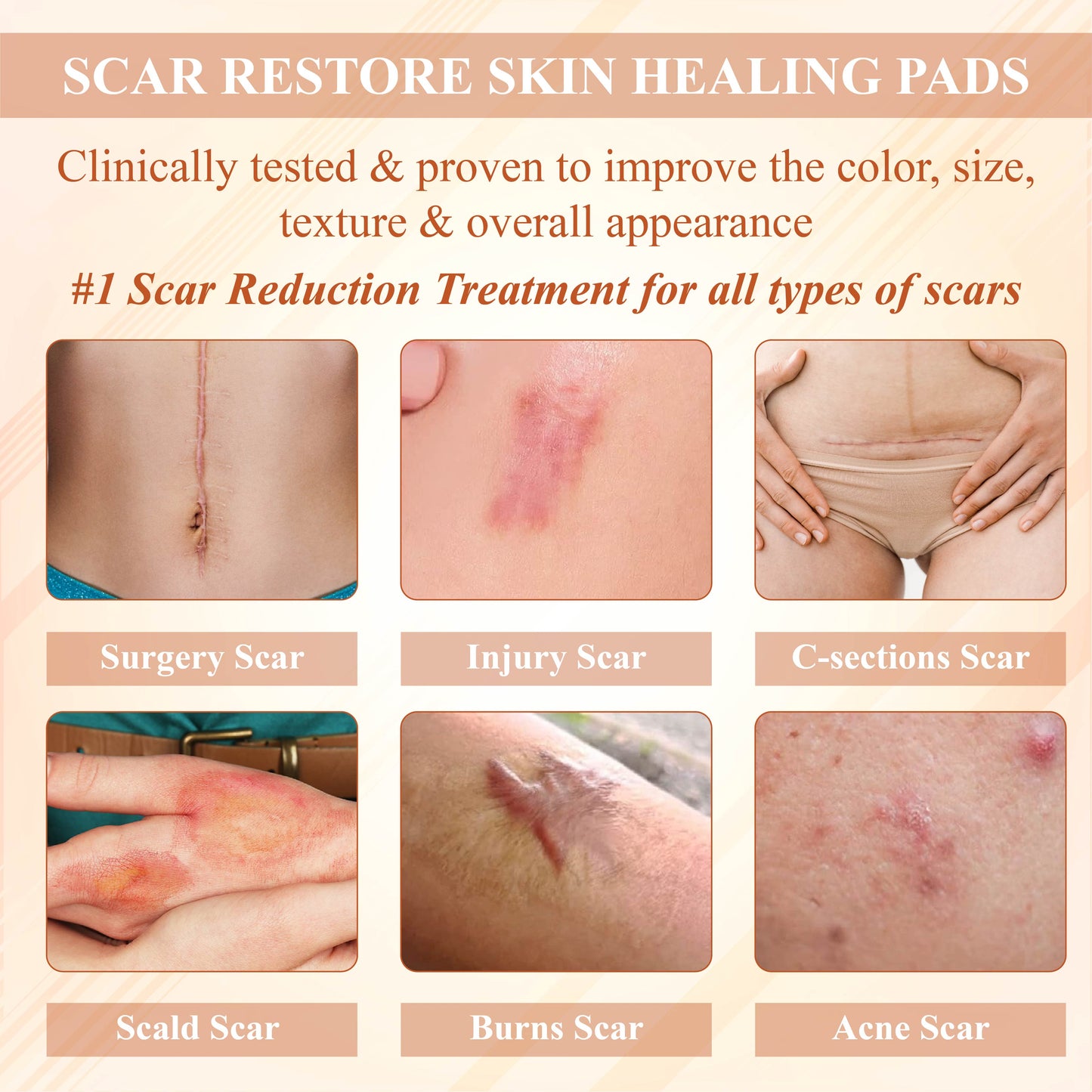 Fivfivgo™ ScarEase Silicone Foam Healing Pads