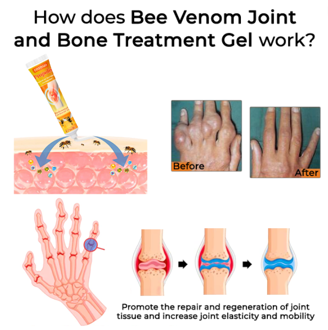 Fivfivgo™ Bee Venom Joint and Bone Treatment Gel