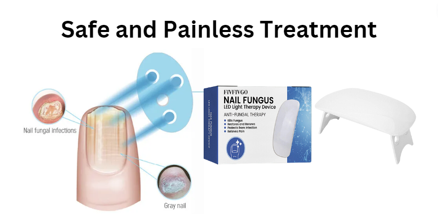 Fivfivgo™ Dispositif révolutionnaire de luminothérapie pour les maladies des ongles d'orteils