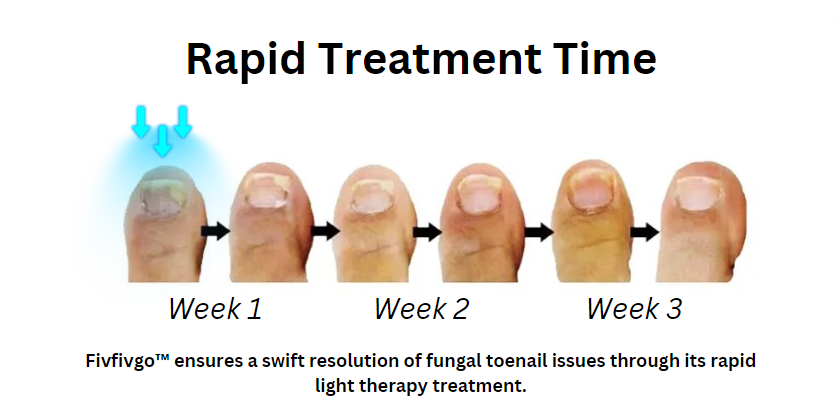 Fivfivgo™ Dispositif révolutionnaire de luminothérapie pour les maladies des ongles d'orteils