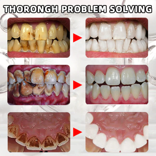 Fivfivgo™ 1% Dentifrice à l'acide alpha-hydroxylé TAmpoule