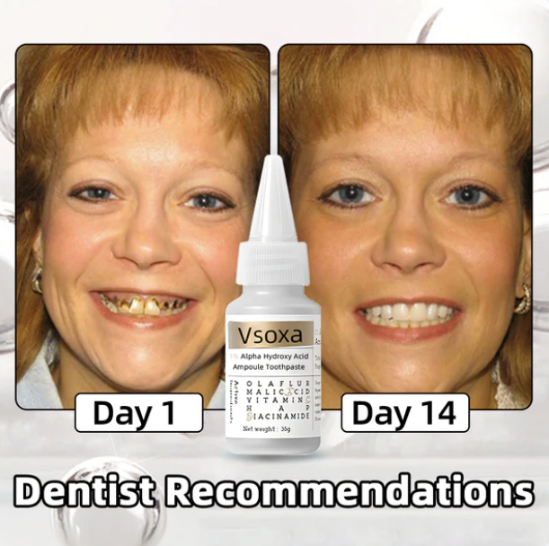 Fivfivgo™ 1% Alpha Hydroxy Acid TAmpoule Toothpaste