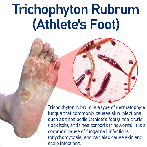 Fivfivgo™ Medical Nail Fungus Foot Spray