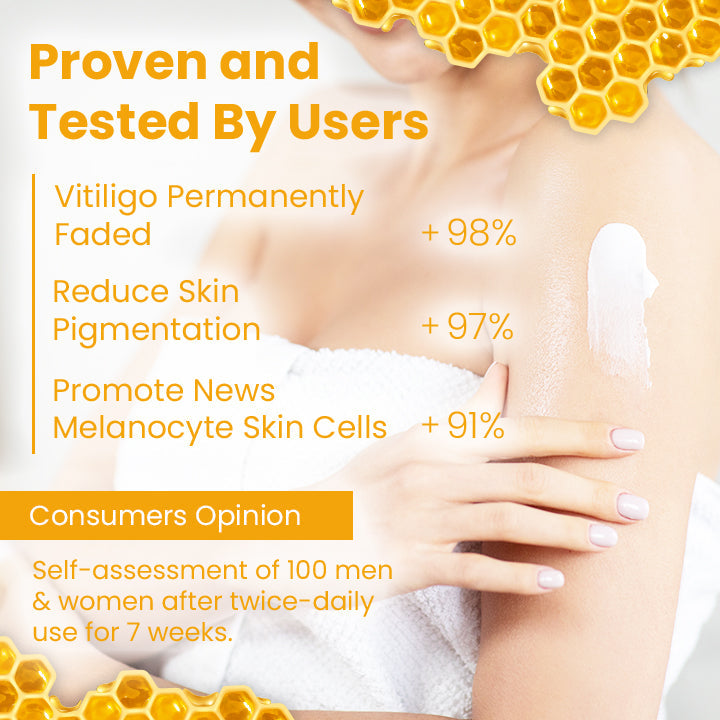 Fivfivgo™ Vitiligo Rescue Bienengift Pflegecreme