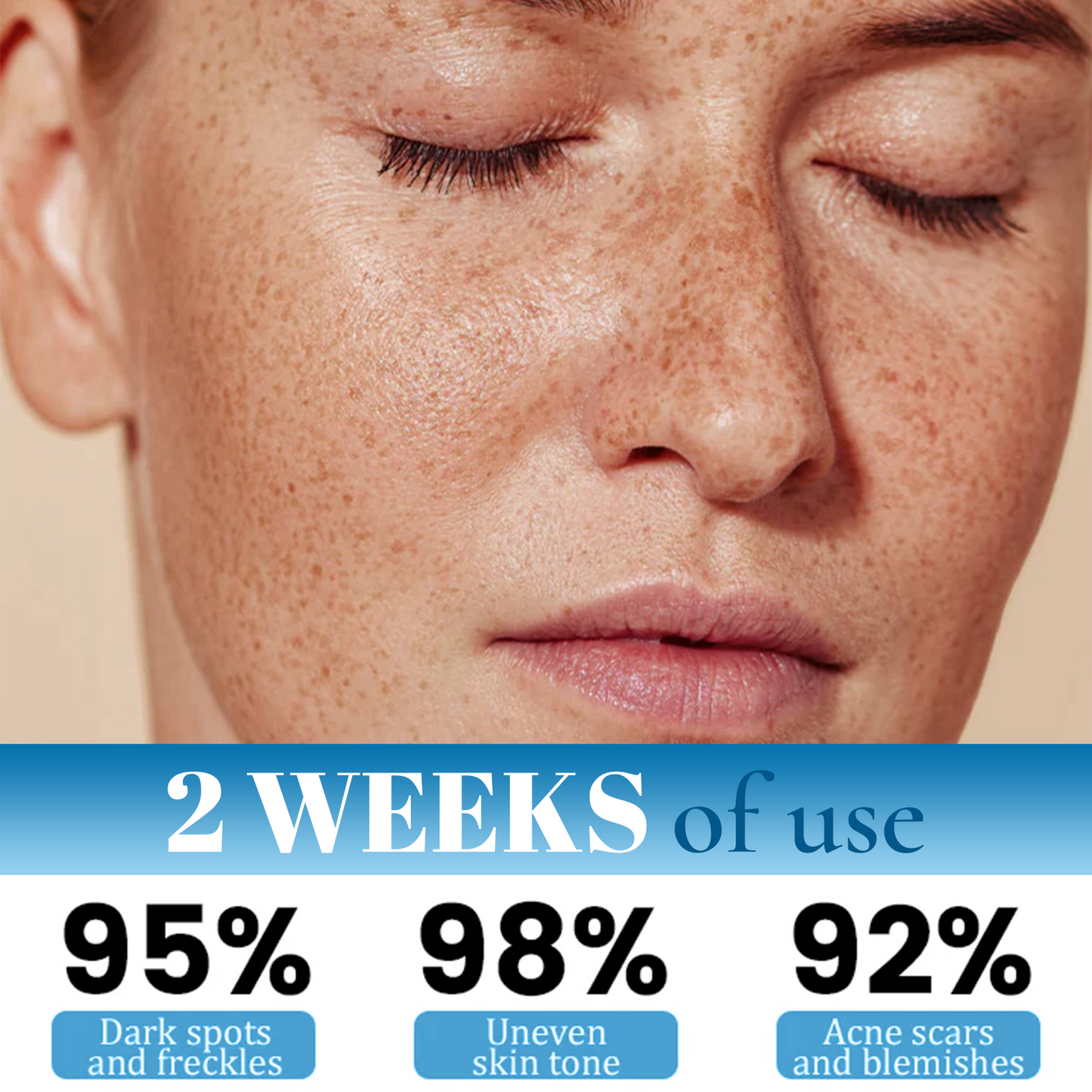Fivfivgo® MelantraX Anti-Hyperpigmentation Essence