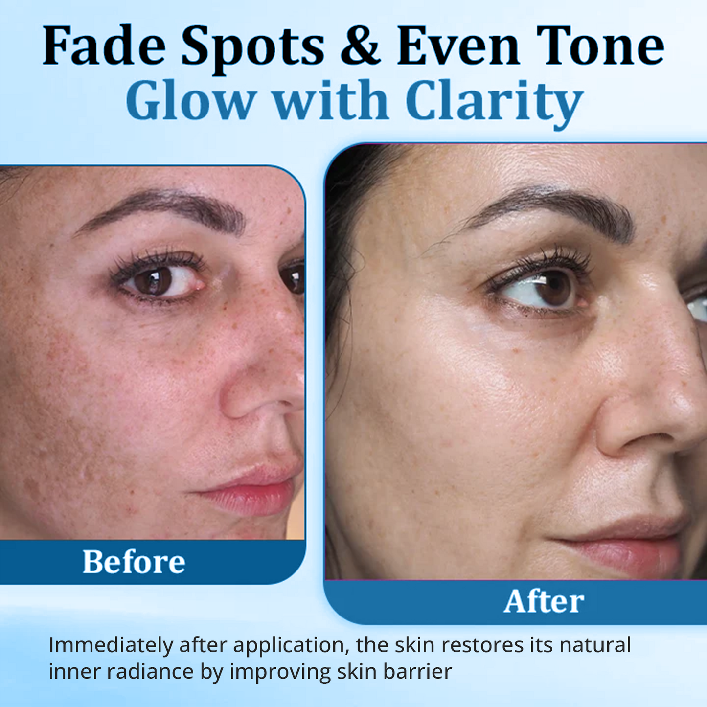 Fivfivgo® MelantraX Anti-Hyperpigmentation Essence