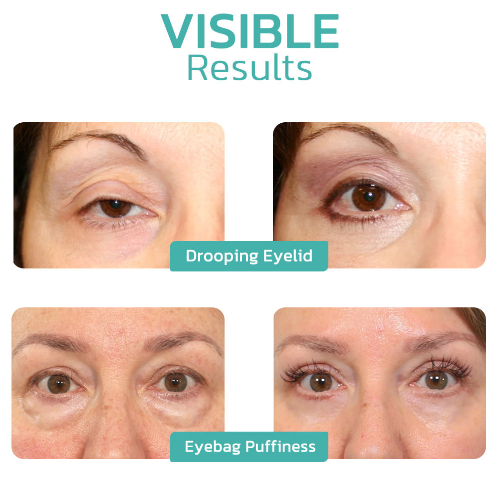 Fivfivgo™ CELYN Crème pour les yeux Peptide Taut